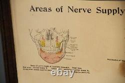 Rare Original Vintage Large Framed Fischer's Local Anesthesia Chart