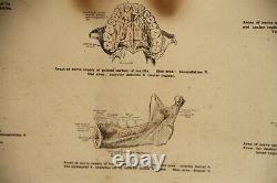 Rare Original Vintage Large Framed Fischer's Local Anesthesia Chart