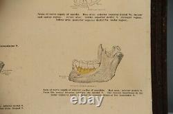 Rare Original Vintage Large Framed Fischer's Local Anesthesia Chart